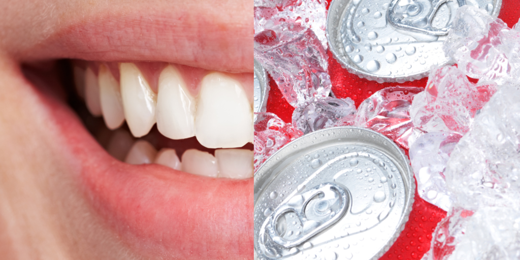 Soda on Teeth