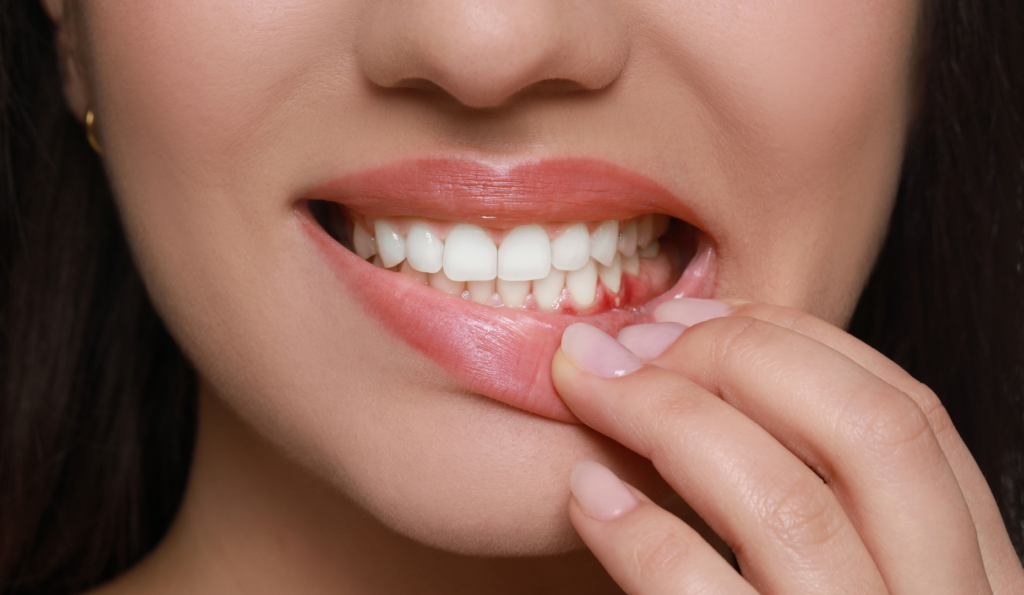 Ways to Keep Your Gums Healthy